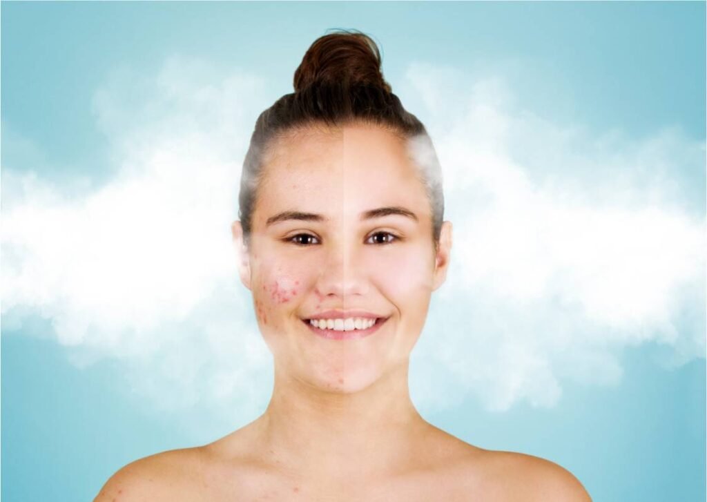 Cryo Facial - Frotox - Allegra Wellness Spa Florida