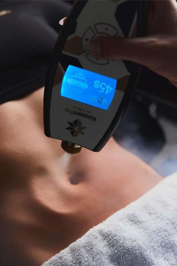 Cryo Slimming sessions Ruskin