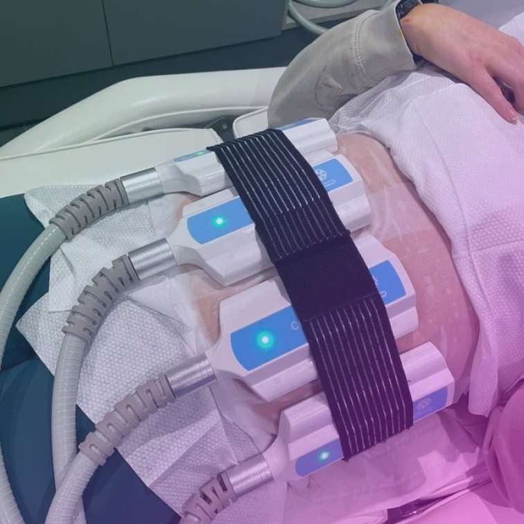 Cryo slimming 2