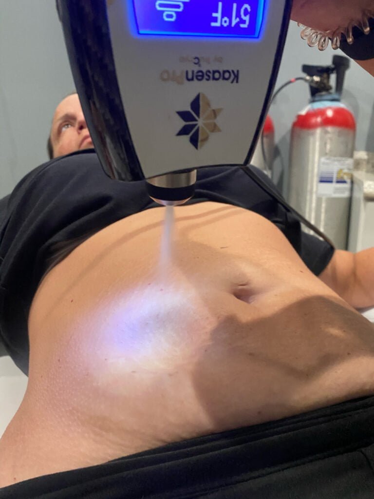 Cryo slimming Sessions